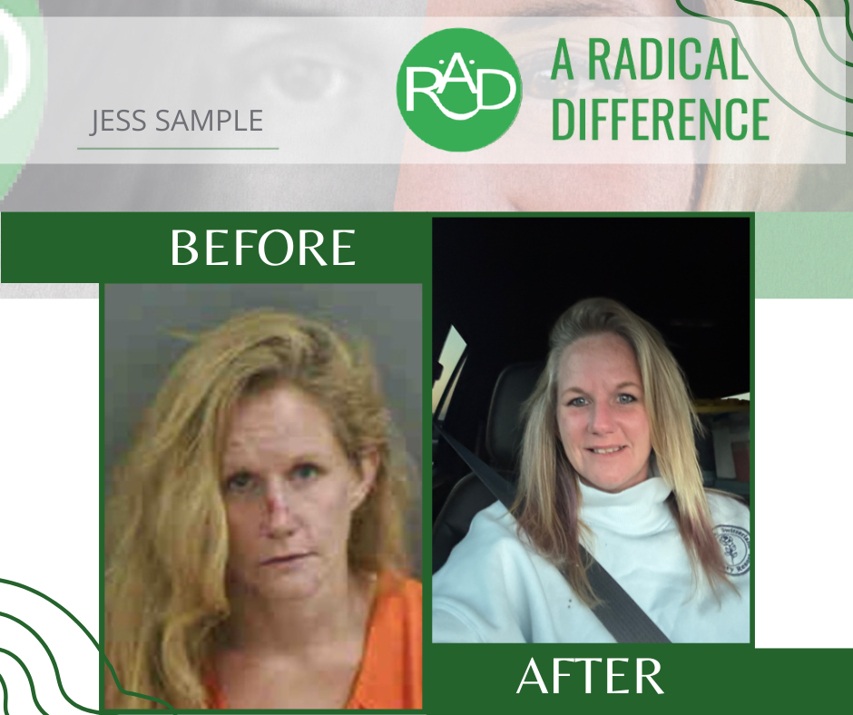 Jessica Sample Before and After